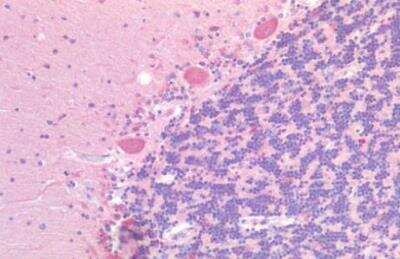 Immunohistochemistry-Paraffin: GPR87 Antibody - BSA Free [NLS1580]