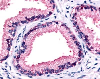 Immunohistochemistry-Paraffin: GPR87 Antibody - BSA Free [NLS1584]