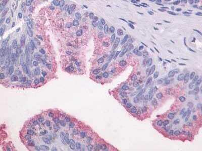 Immunohistochemistry-Paraffin: GPR87 Antibody - BSA Free [NLS1585]