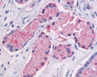 Immunohistochemistry-Paraffin: GPR87 Antibody - BSA Free [NLS1585]