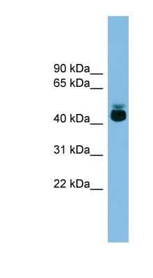 Western Blot: GPR87 Antibody [NBP1-56442]