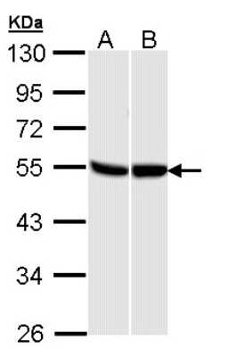 Western Blot: GPR87 Antibody [NBP2-16728]