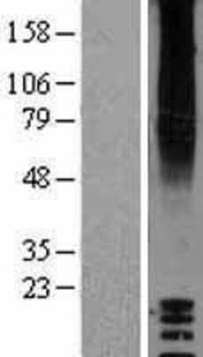 Western Blot: GPR87 Overexpression Lysate [NBP2-04391]