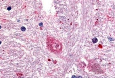 Immunohistochemistry-Paraffin: GPR88 Antibody - BSA Free [NBP1-02330]