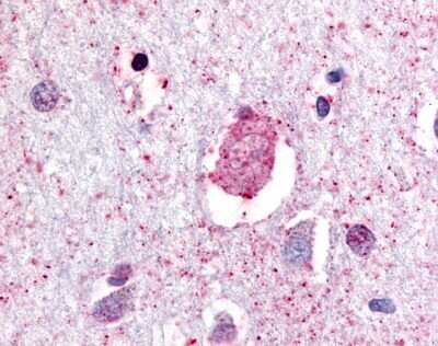 Immunohistochemistry-Paraffin: GPR88 Antibody - BSA Free [NLS1572]