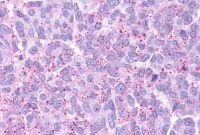 Immunohistochemistry-Paraffin: GPR88 Antibody - BSA Free [NLS1572]