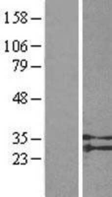 Western Blot: SUCNR1/GPR91 Overexpression Lysate [NBL1-16595]