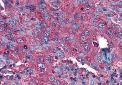 Immunohistochemistry: GPR97 Antibody [NBP3-14364]