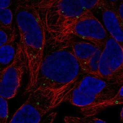 Immunocytochemistry/ Immunofluorescence: GPR98 Antibody [NBP2-57048]