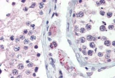 Immunohistochemistry-Paraffin: GPR98 Antibody [NBP3-14365]