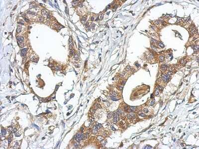 Immunohistochemistry-Paraffin: GPRASP2 Antibody [NBP2-16729]