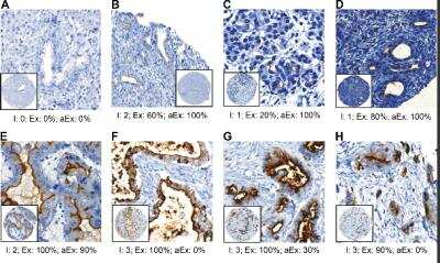 Immunohistochemistry Free-Floating: GPRC5A/RAI3 Antibody [NBP1-89743]