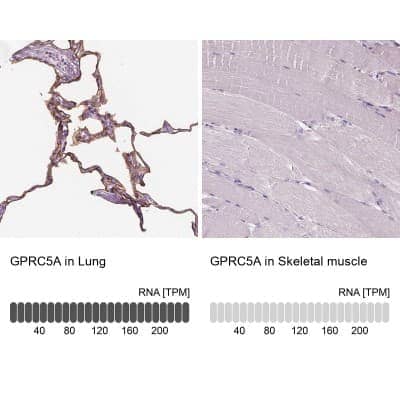 Immunohistochemistry-Paraffin: GPRC5A/RAI3 Antibody [NBP1-89743]