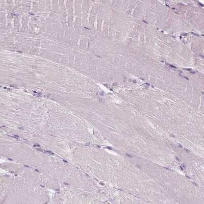 Immunohistochemistry-Paraffin: GPRC5A/RAI3 Antibody [NBP1-89743]