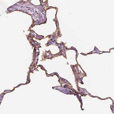 Immunohistochemistry-Paraffin: GPRC5A/RAI3 Antibody [NBP1-89743]
