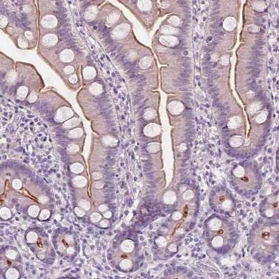 Immunohistochemistry-Paraffin: GPRC5A/RAI3 Antibody [NBP1-89743]