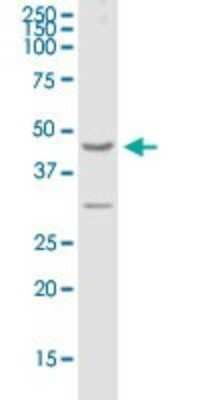 Western Blot: GPRC5A/RAI3 Antibody [H00009052-B01P]