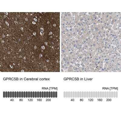 Immunohistochemistry-Paraffin: GPRC5B Antibody [NBP1-87160]