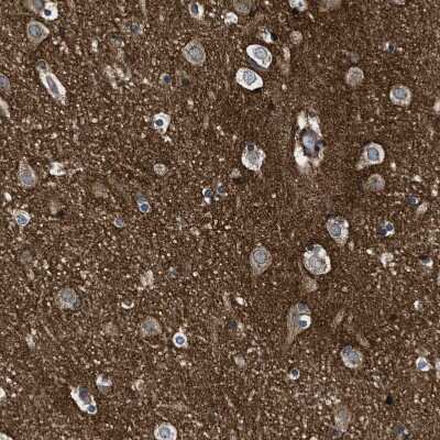 Immunohistochemistry-Paraffin: GPRC5B Antibody [NBP1-87160]