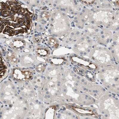 Immunohistochemistry-Paraffin: GPRC5B Antibody [NBP1-87160]
