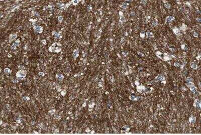 Immunohistochemistry-Paraffin: GPRC5B Antibody [NBP1-87160]