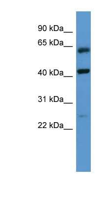 Western Blot: GPRC5B Antibody [NBP1-69040]