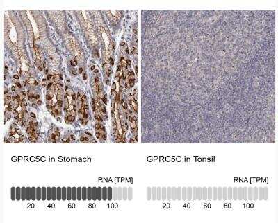 Immunohistochemistry-Paraffin: GPRC5C Antibody [NBP1-87159]