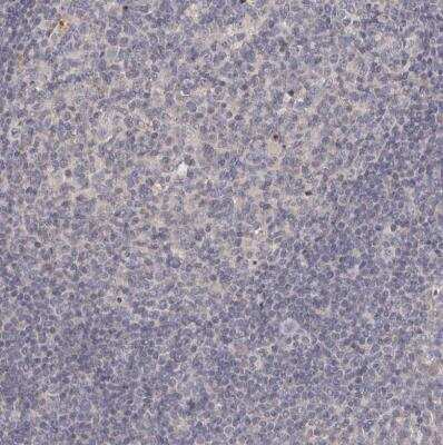 Immunohistochemistry-Paraffin: GPRC5C Antibody [NBP1-87159]