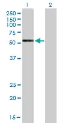 Western Blot: GPRC5C Antibody [H00055890-B01P]