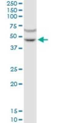 Western Blot: GPRC5C Antibody [H00055890-B01P]