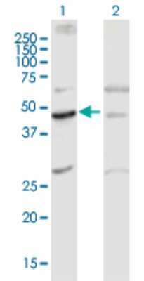 Western Blot: GPRC5C Antibody [H00055890-B01P]