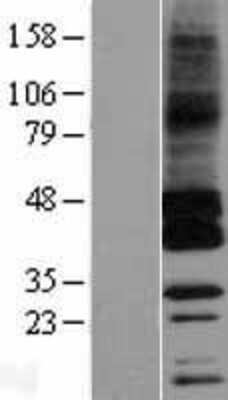 Western Blot: GPRC5C Overexpression Lysate [NBP2-04388]