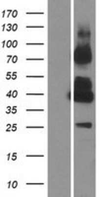 Western Blot: GPRC5C Overexpression Lysate [NBP2-06781]