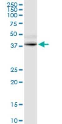 Western Blot: GPRC5D Antibody (6D9) [H00055507-M01]