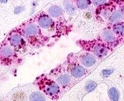 Immunohistochemistry-Paraffin: GPRC5D Antibody - BSA Free [NLS568]