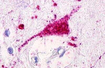 Immunohistochemistry-Paraffin: GPRC5D Antibody - BSA Free [NLS568]