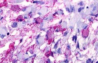 Immunohistochemistry-Paraffin: GPRC5D Antibody - BSA Free [NLS568]