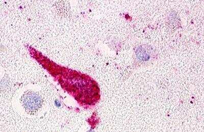 Immunohistochemistry-Paraffin: GPRC5D Antibody - BSA Free [NLS568]