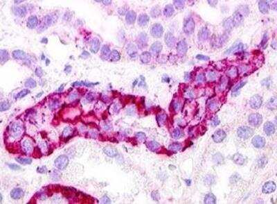 Immunohistochemistry-Paraffin: GPRC5D Antibody - BSA Free [NLS571]
