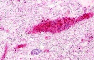 Immunohistochemistry-Paraffin: GPRC5D Antibody - BSA Free [NLS571]