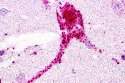 Immunohistochemistry-Paraffin: GPRC5D Antibody - BSA Free [NLS571]