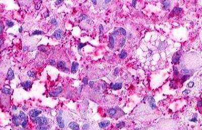 Immunohistochemistry-Paraffin: GPRC5D Antibody - BSA Free [NLS571]