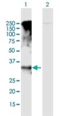 Western Blot: GPRC5D Antibody [H00055507-B01P]