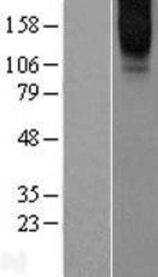 Western Blot: GPRC6A Overexpression Lysate [NBL1-11306]