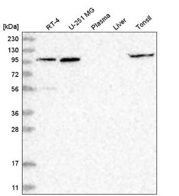 Western Blot: GPRIN1 Antibody [NBP2-55391]