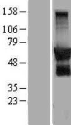 Western Blot: GPRIN2 Overexpression Lysate [NBP2-07294]