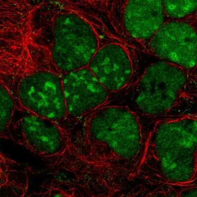 Immunocytochemistry/ Immunofluorescence: GPRIN3 Antibody [NBP2-55585]