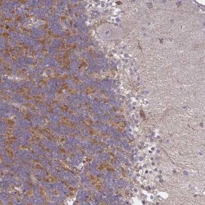 Immunohistochemistry-Paraffin: GPRIN3 Antibody [NBP2-32424]