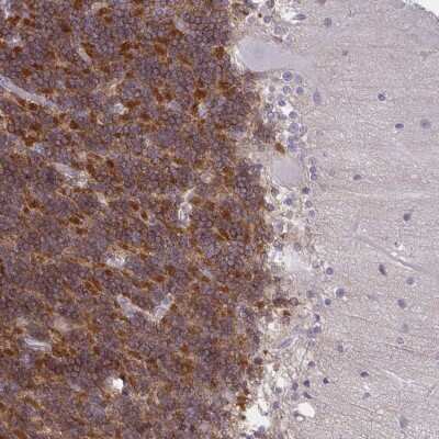 Immunohistochemistry-Paraffin: GPRIN3 Antibody [NBP2-33841]