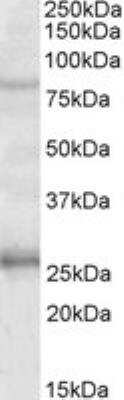 Western Blot: GPRIN3 Antibody [NBP2-27570]